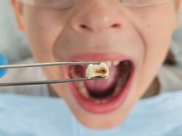 Best Emergency Pediatric Dentist  in Middlebury, IN